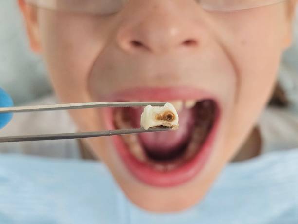 Best Emergency Gum Pain Relief  in Milledgeville, GA